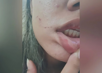Segunda jovem afirma ter sido agredida por médico em Juazeiro do Norte: ‘Disse que iria me matar’