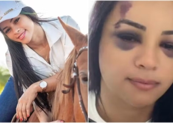 Influenciadora agredida com taco de sinuca deixa hospital; ex suspeito do crime segue foragido